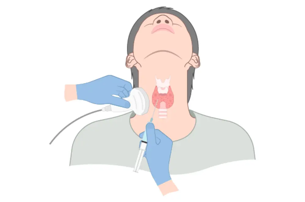 Types of Biopsy and Image-Guided Approaches